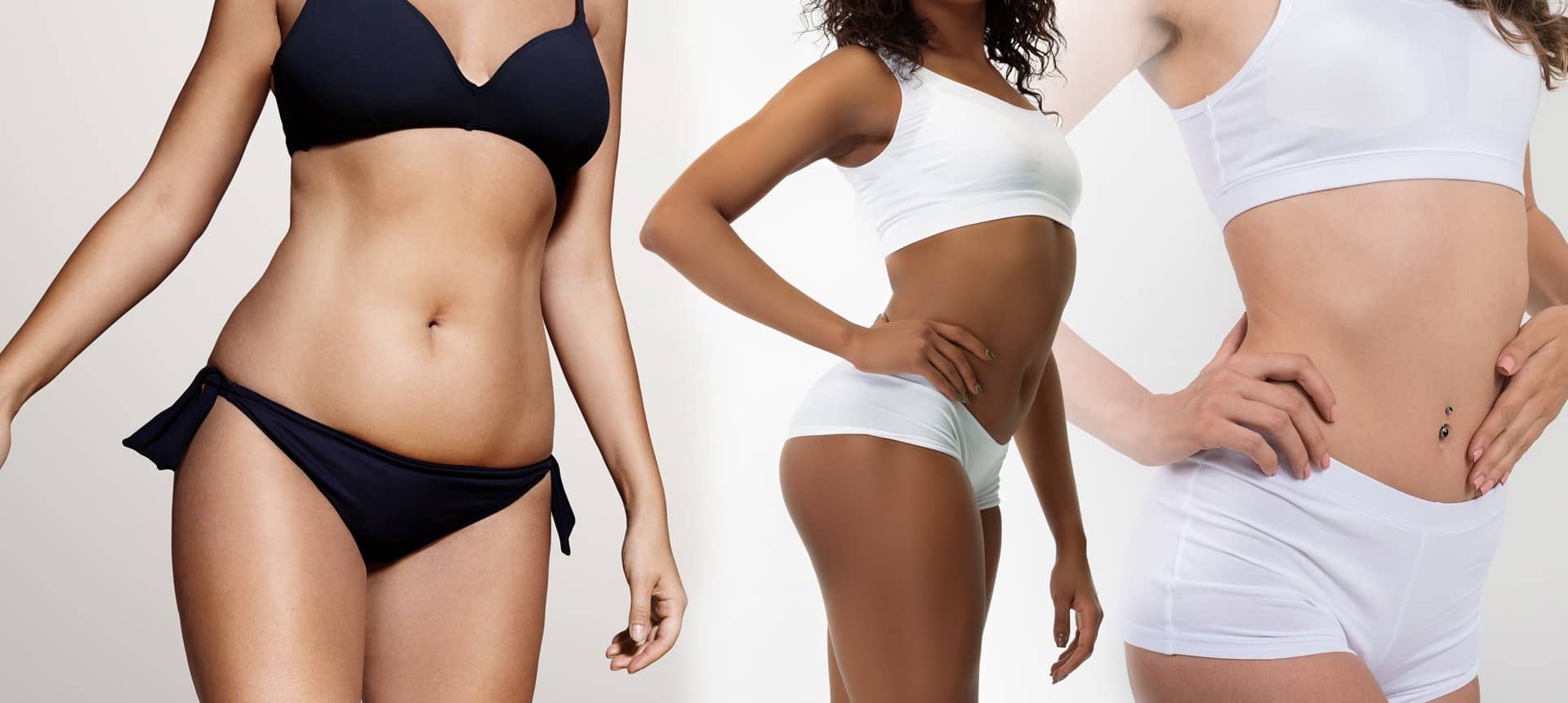Tummy Tuck